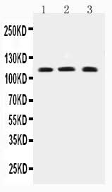 Anti-TRPC4 Antibody Picoband® Boster Bio