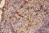 Anti-C5/C5a Antibody Picoband® Boster Bio