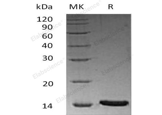 Recombinant Human LRRC3B Protein (His Tag) - ABMIUM