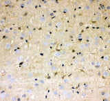 Anti-DDAH1 Antibody Picoband® Boster Bio