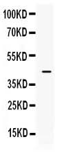 Anti-ITLN1 Antibody Picoband® Boster Bio