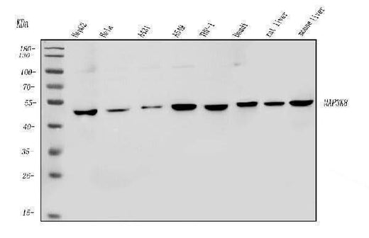 Anti-MAP3K8 Antibody Picoband® Boster Bio