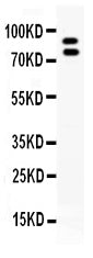 Anti-MMP9 Antibody Picoband® Boster Bio