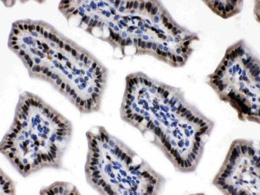 Anti-Visfatin/NAMPT Antibody Picoband® Boster Bio