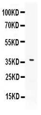 Anti-B7 DC/PDCD1LG2 Antibody Picoband® Boster Bio