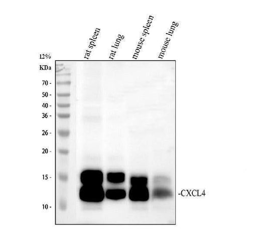Anti-PF4 Antibody Picoband® Boster Bio