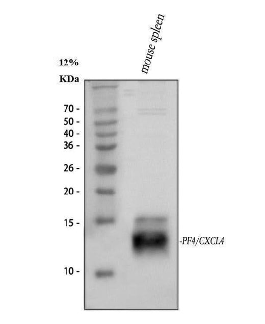 Anti-PF4 Antibody Picoband® Boster Bio