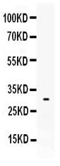 Anti-Mast Cell Tryptase/TPSAB1 Antibody Picoband® Boster Bio