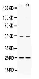 Anti-SYBL1/VAMP7 Antibody Picoband® Boster Bio