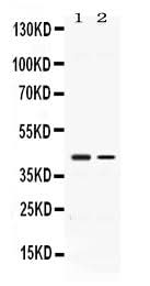 Anti-Abhd5 Antibody Picoband® Boster Bio