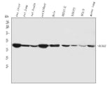 Anti-ACAA2 Antibody Picoband® Boster Bio