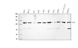 Anti-ATP citrate lyase/ACLY Antibody Picoband® Boster Bio