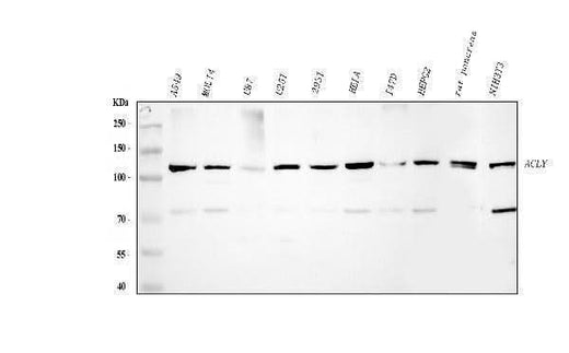 Anti-ATP citrate lyase/ACLY Antibody Picoband® Boster Bio