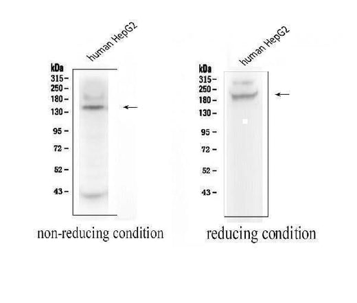 Anti-ADAMTS13 Antibody Picoband® Boster Bio