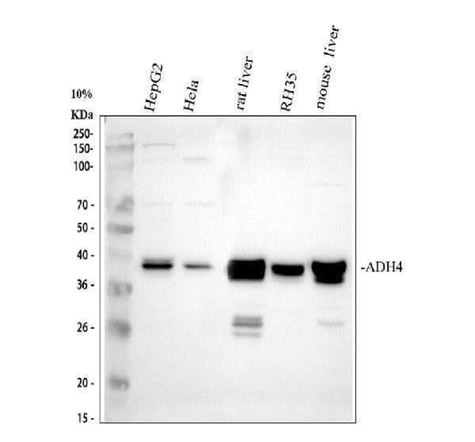 Anti-ADH4 Antibody Picoband® Boster Bio