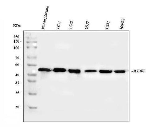 Anti-ADK Antibody Picoband® Boster Bio