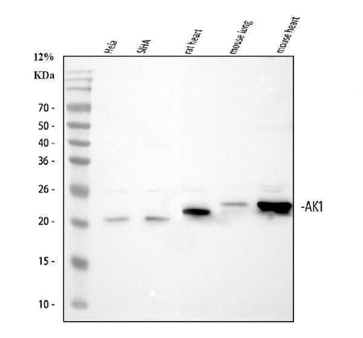 Anti-Adenylate Kinase 1/AK1 Antibody Picoband® Boster Bio