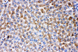 Anti-AK2 Antibody Picoband® Boster Bio