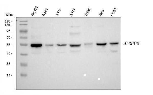 Anti-ALDH1B1 Antibody Picoband® Boster Bio