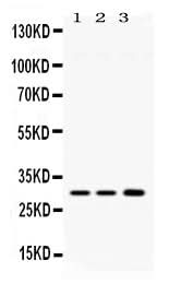 Anti-AQP11 Antibody Picoband® Boster Bio