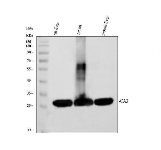 Anti-Carbonic Anhydrase III/CA3 Antibody Picoband® Boster Bio
