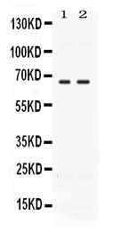 Anti-CCDC6 Antibody Picoband® Boster Bio