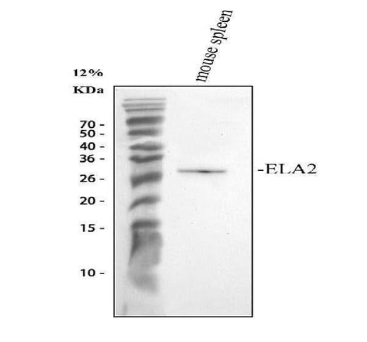 Anti-Neutrophil Elastase/ELANE Antibody Picoband® Boster Bio