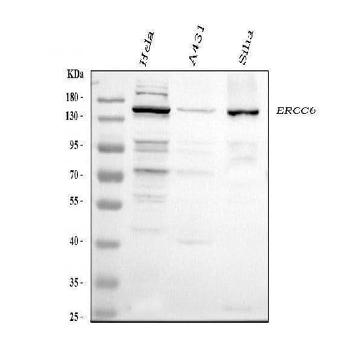 Anti-CSB/ERCC6 Antibody Picoband® Boster Bio