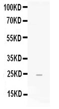 Anti-FGF19 Antibody Picoband® Boster Bio