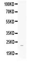 Anti-FGF21 Antibody Picoband® Boster Bio