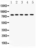 Anti-FSH Receptor/FSHR Antibody Picoband® Boster Bio