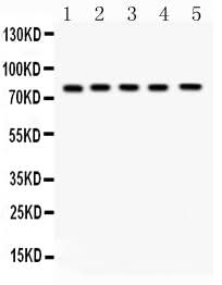 Anti-FSH Receptor/FSHR Antibody Picoband® Boster Bio