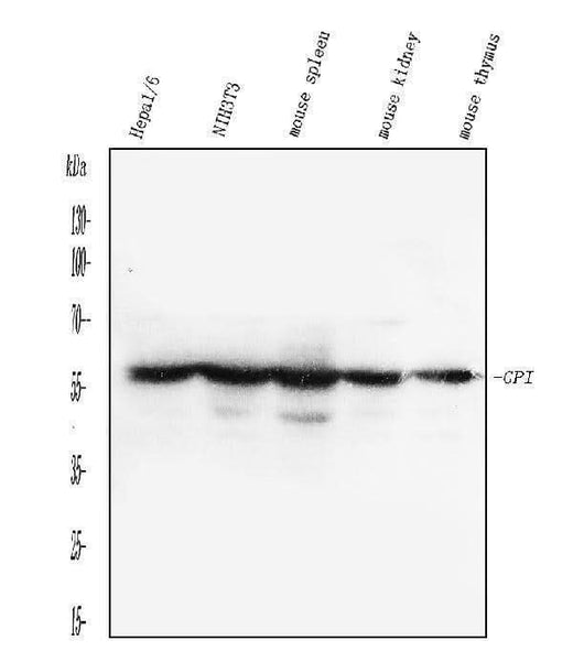 Anti-Glucose 6 phosphate isomerase/GPI Antibody Picoband® Boster Bio