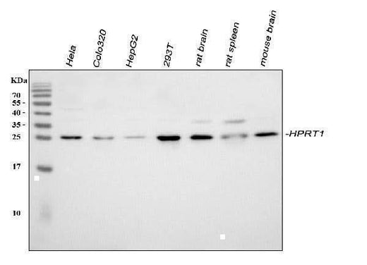 Anti-HPRT/HPRT1 Antibody Picoband® Boster Bio