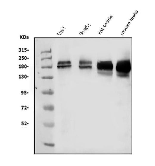 Anti-KDM5B/PLU1/Jarid1B Antibody Picoband® Boster Bio