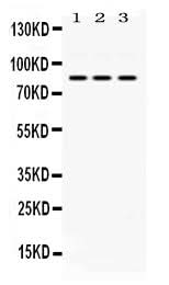 Anti-KRIT1 Antibody Picoband® Boster Bio