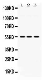 Anti-MPP1 Antibody Picoband® Boster Bio