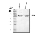 Anti-MPP2 Antibody Picoband® Boster Bio