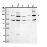 Anti-PML Protein Antibody Picoband® Boster Bio