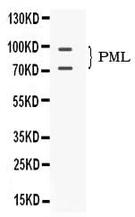 Anti-PML Protein Antibody Picoband® Boster Bio