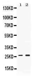 Anti-Proteasome 20S alpha 2/PSMA2 Antibody Picoband® Boster Bio