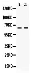Anti-PVRL4/NECTIN4 Antibody Picoband® Boster Bio