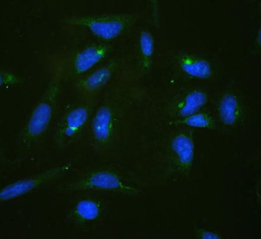 Anti-RPL19 Antibody Picoband® Boster Bio
