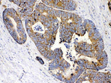 Anti-MPS1/RPS27 Antibody Picoband® Boster Bio
