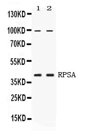 Anti-67kDa Laminin Receptor/RPSA Antibody Picoband® Boster Bio