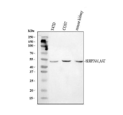 Anti-alpha 1 Antitrypsin/SERPINA1 Antibody Picoband® Boster Bio