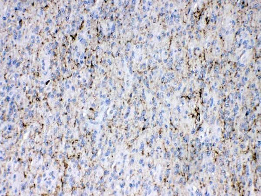 Anti-Synapsin I/SYN1 Antibody Picoband® Boster Bio