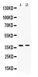 Anti-TNFRSF14 Antibody Picoband® Boster Bio