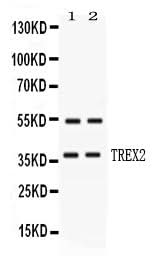 Anti-TREX2 Antibody Picoband® Boster Bio