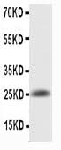 Anti-IL6 Antibody Picoband® Boster Bio